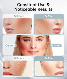 Dopsikn Massager Visage 7 Couleurs en usage sur le visage