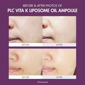 Dr.Ceuracle PLC Vita K Ampoule 50 ml avec compte-gouttes