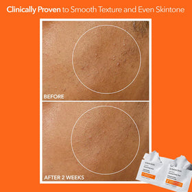 Dr Dennis Gross Alpha Beta Daily Peel - ingrédients principaux