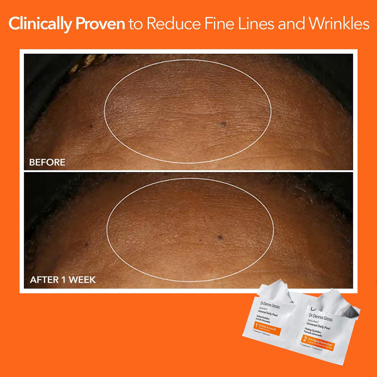 Dr Dennis Gross Alpha Beta Daily Peel - utilisation quotidienne