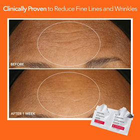 Dr Dennis Gross Alpha Beta Extra Strength Daily Peel vue arrière