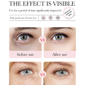 Eakroo Patches pour les Yeux en rose, présentation du produit
