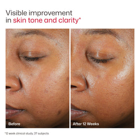 EltaMD Crème Solaire sur fond naturel