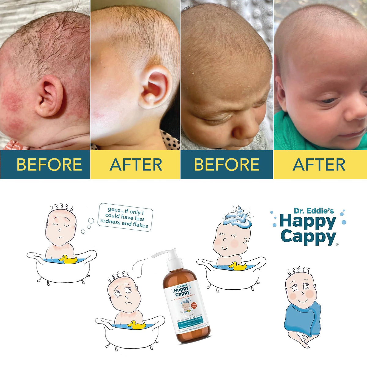 Emballage de Happy Cappy Shampooing Médicamenteux en vue de côté