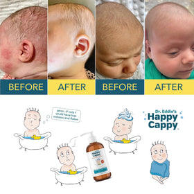 Emballage de Happy Cappy Shampooing Médicamenteux en vue de côté