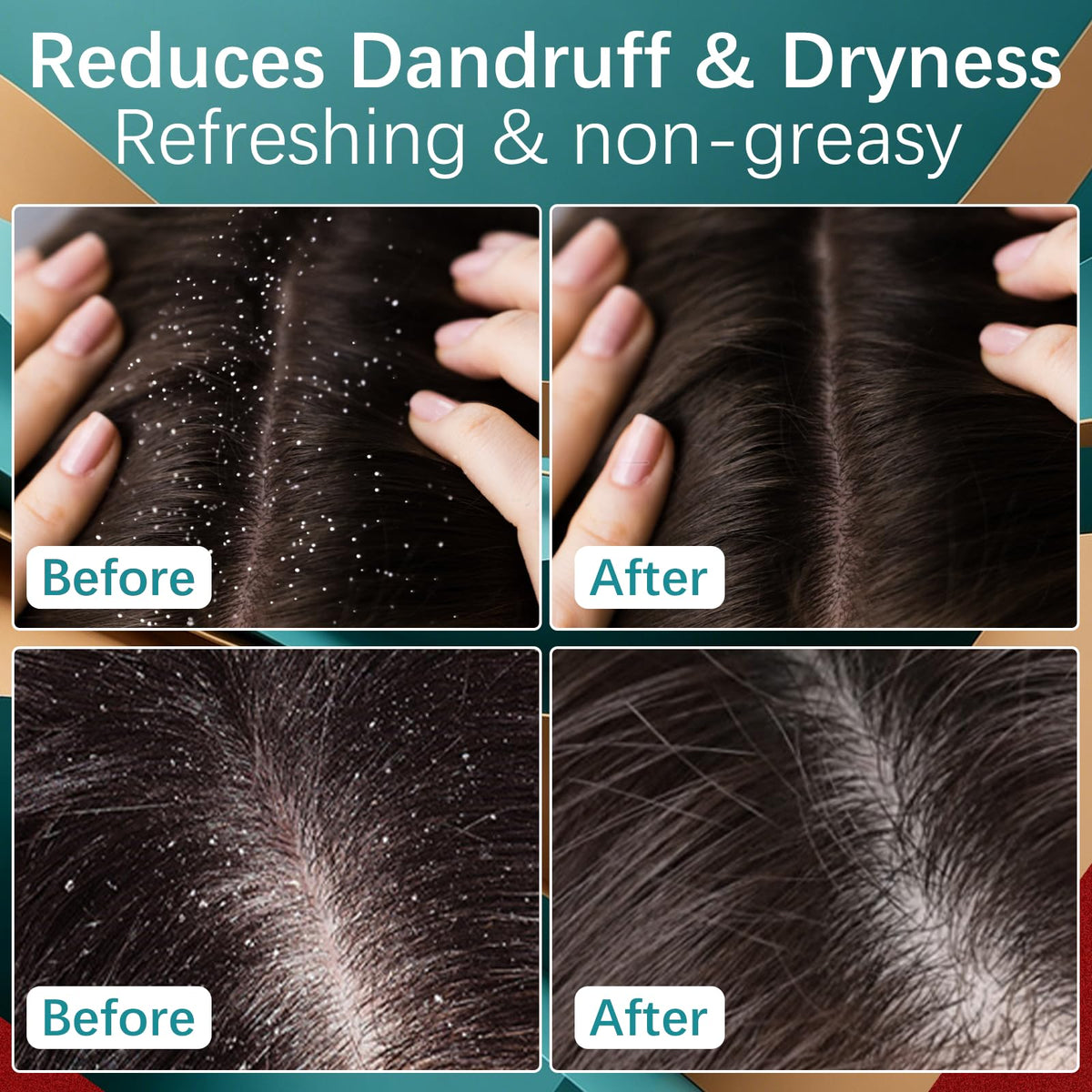 Emballage de la crème MQN 5% Minoxidil