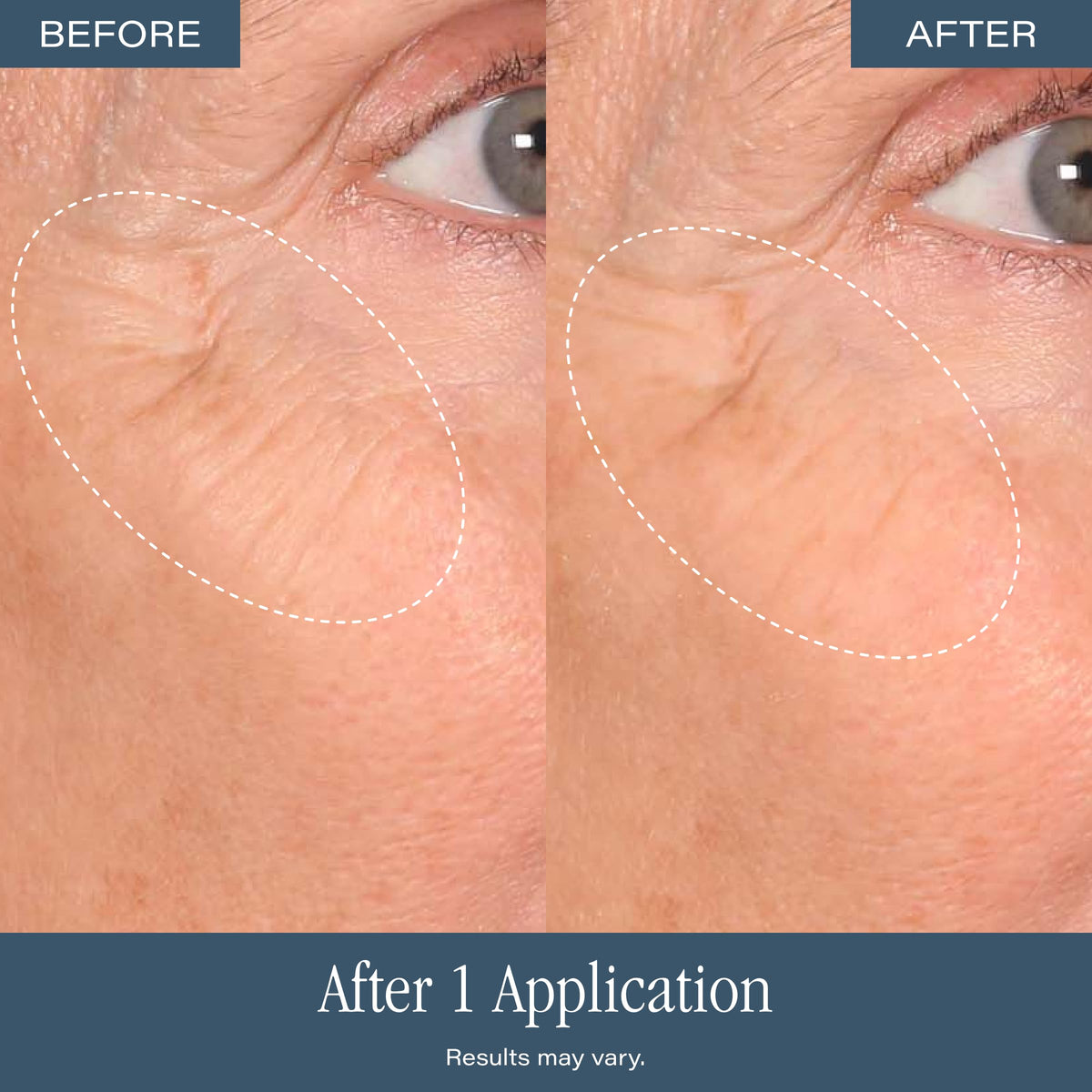 Emballage du gommage SKINN DermAppeal® sur une surface neutre