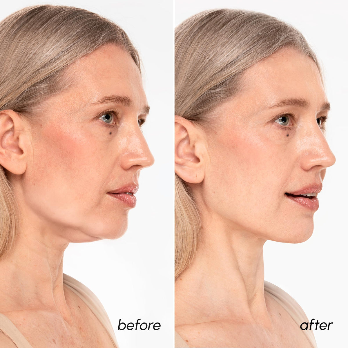 Emballage du masque V Line Lifting MAREE