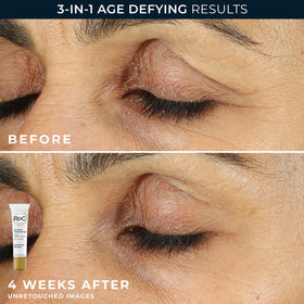 Emballage du set RoC Retinol Correxion sur fond blanc