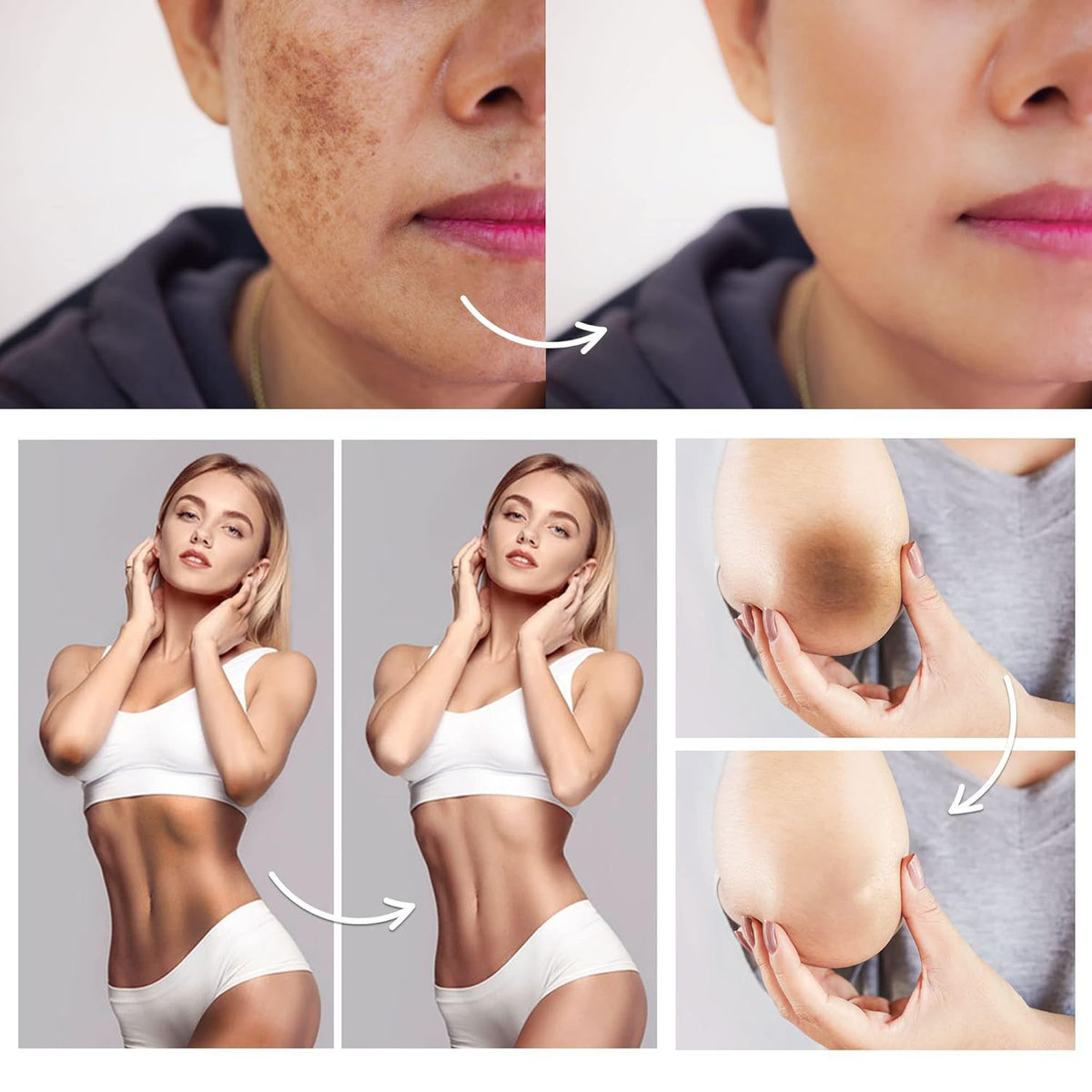 FAMIROSA Crème Correctrice de Taches Sombres 340g application sur la peau