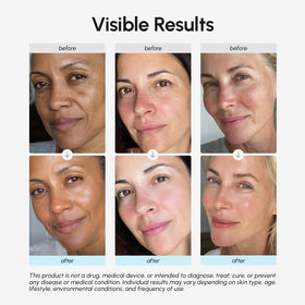 Femme appliquant la crème MAREE sur son visage