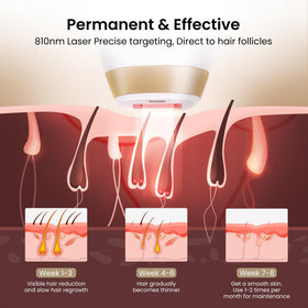 Femme utilisant l'épilateur laser DermRays à domicile