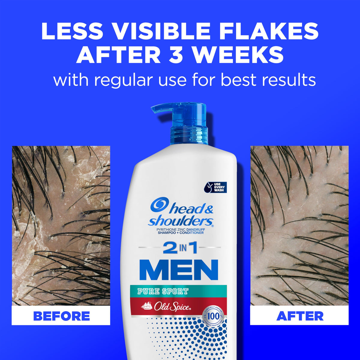 Flacons de shampooing Head & Shoulders 2-en-1 sur fond neutre