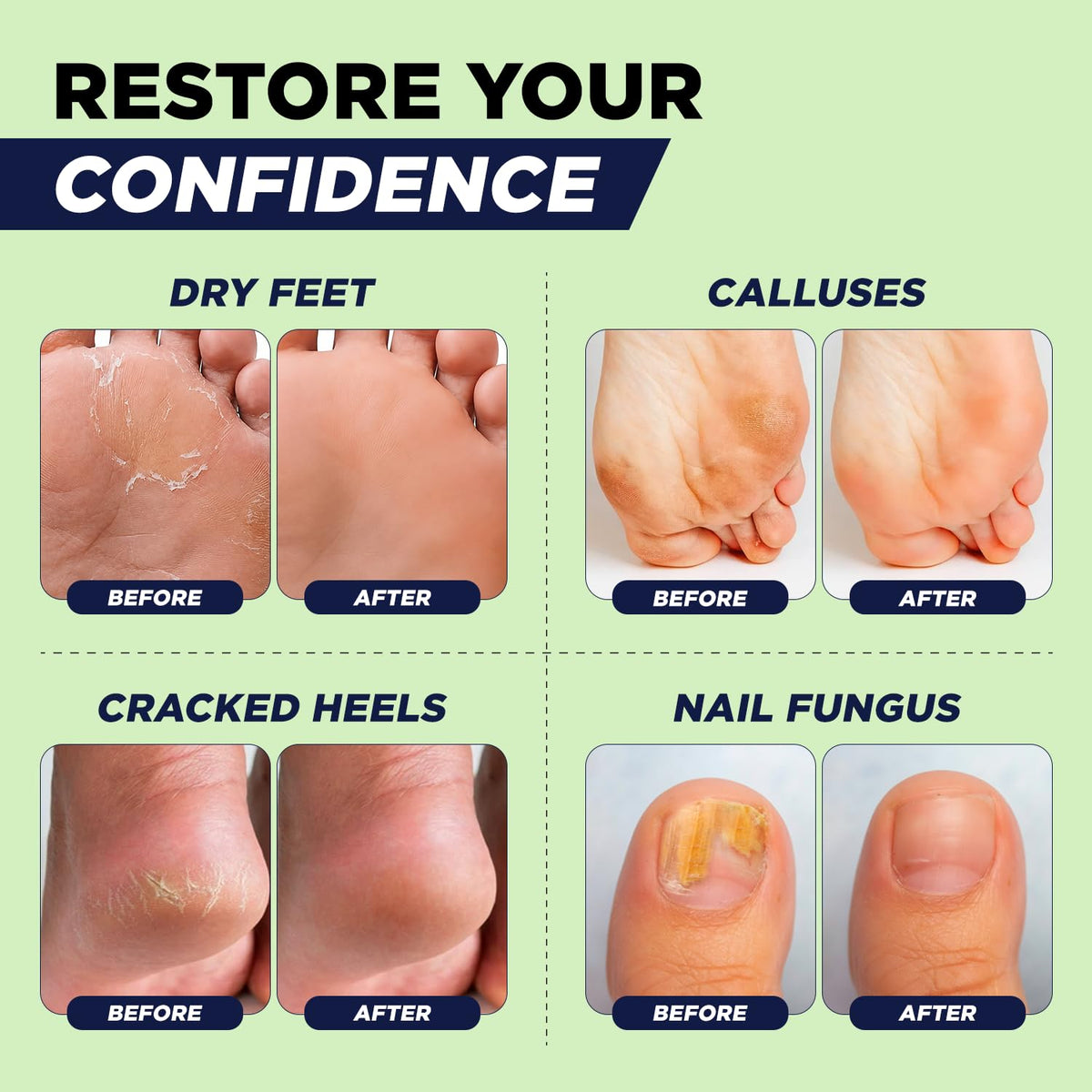 FOOT Bain de Pieds à l'Huile d'Arbre à Thé, ingrédients naturels