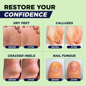 FOOT Bain de Pieds à l'Huile d'Arbre à Thé, ingrédients naturels