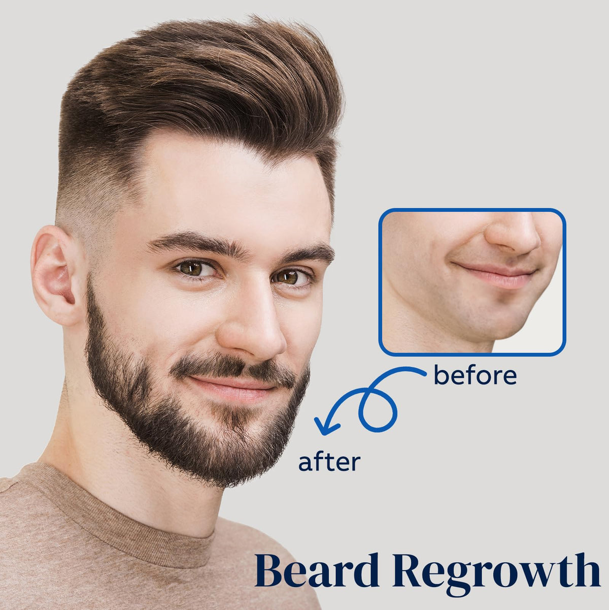 FUZYAT Spray de Croissance Capillaire 5% Minoxidil 120ml côté droit