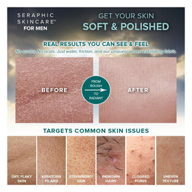 Gant exfoliant SERAPHIC SKINCARE, vue arrière