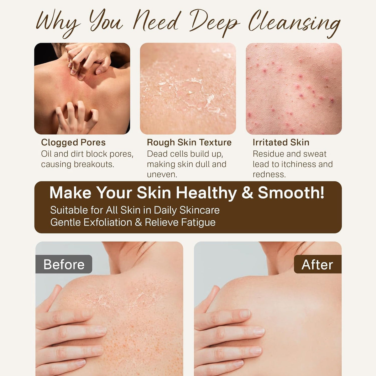 Gants exfoliants Fundrem étalés sur une surface, montrant les textures