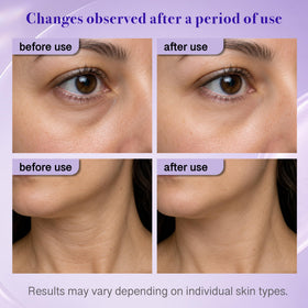 Gel pour le contour des yeux Tetea en utilisation quotidienne