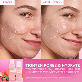 Glow Recipe Tonique PHA + BHA 150ml sur fond de pastèque