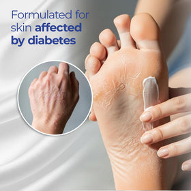 Goicoechea Lotion Diabétique TX Urea application sur peau