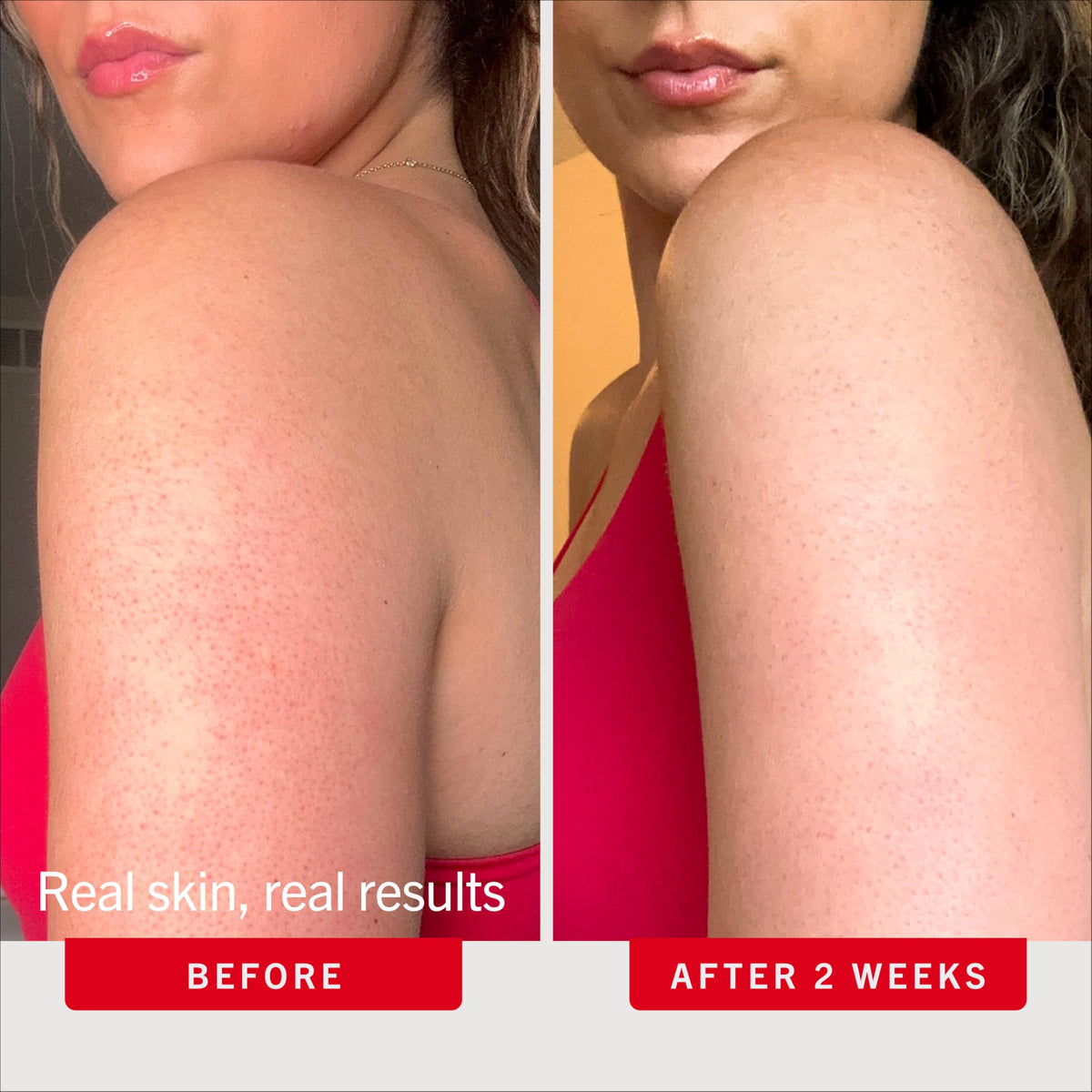 Gommage Corporel KP Bump Eraser First Aid Beauty en application sur la peau