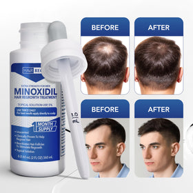 Hair Regen Minoxidil 5% flacons avec accessoires