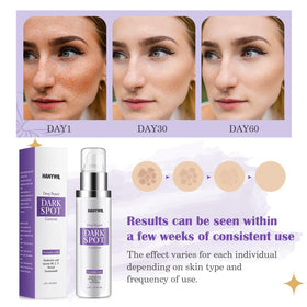 HANYWIL Sérum Éclaircissant Taches Sombres 2% Retinol 5% Niacinamide flacon en gros plan