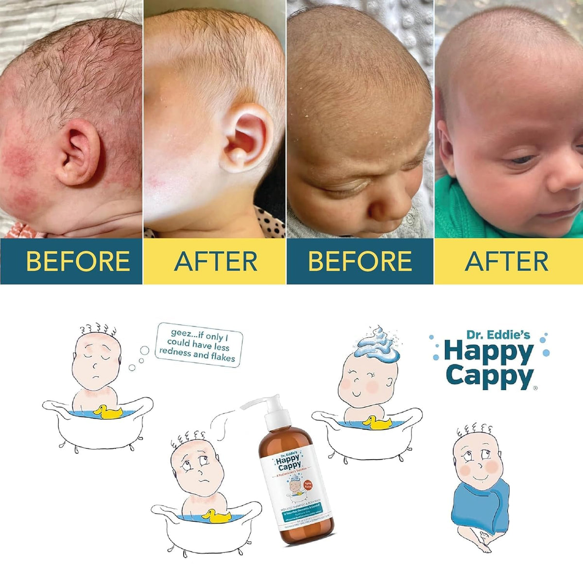Happy Cappy Shampoo Médicamenteux 236 ml avec des ingrédients naturels