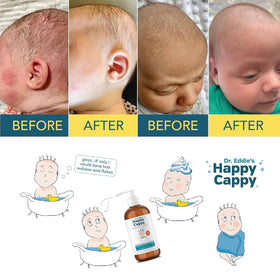 Happy Cappy Shampoo Médicamenteux 236 ml avec des ingrédients naturels