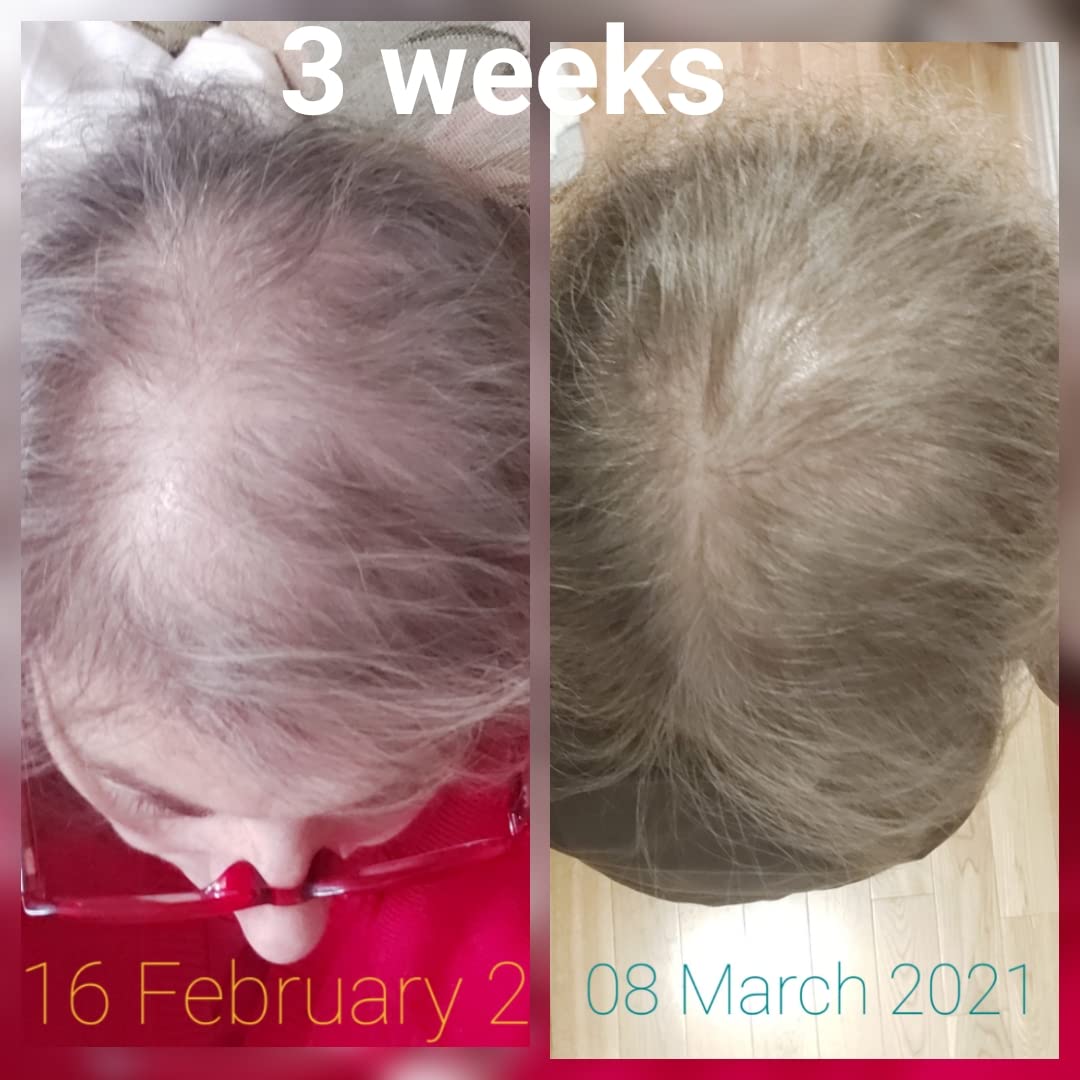Huile CRISAN avec application sur cheveux frisés