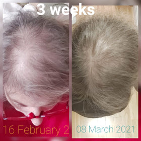 Huile CRISAN avec application sur cheveux frisés