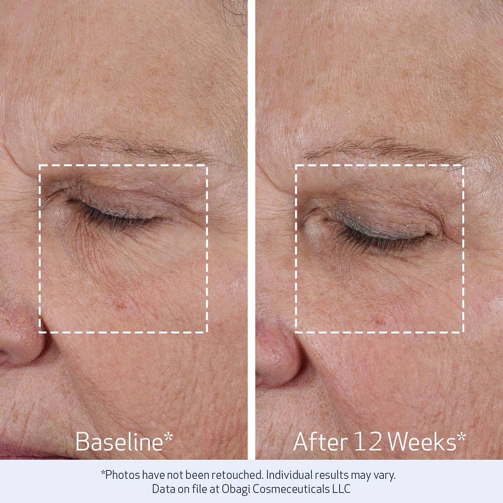 Ingrédients de la crème Obagi Medical ELASTIderm Lift Up