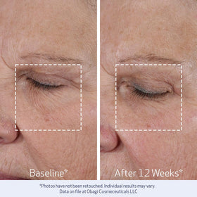 Ingrédients de la crème Obagi Medical ELASTIderm Lift Up