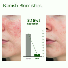 Ingrédients du masque BLITHE Patting Splash Mask Thé Vert