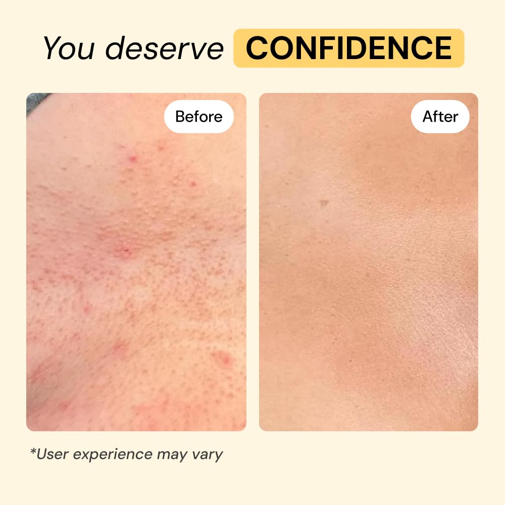 Ingrédients naturels de MyMagicHealer Universal Flare Care