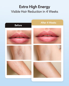 INNZA épilateur IPL avec écran et boutons de réglage