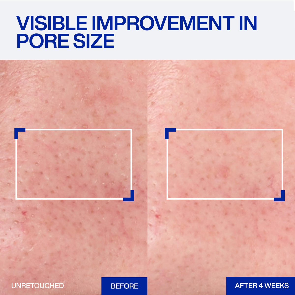 IOPE Expert Retinol RX 1% Sérum sur une table aux côtés d'autres produits de soin