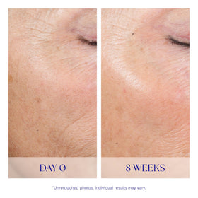 iS CLINICAL Active Peel System texture close-up