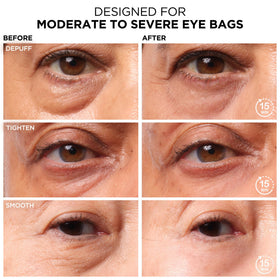 IT Cosmetics traitement de levée des poches sous les yeux 32g vue arrière