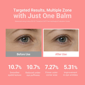 KAHI Baume Multi-Usage application sur la peau