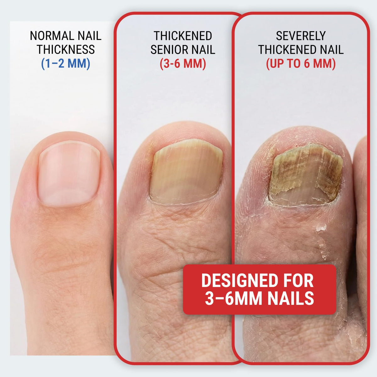 KLIPP Coupe-ongles Large 15 mm avec détail des lames inclinées
