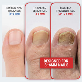 KLIPP Coupe-ongles Large 15 mm avec détail des lames inclinées