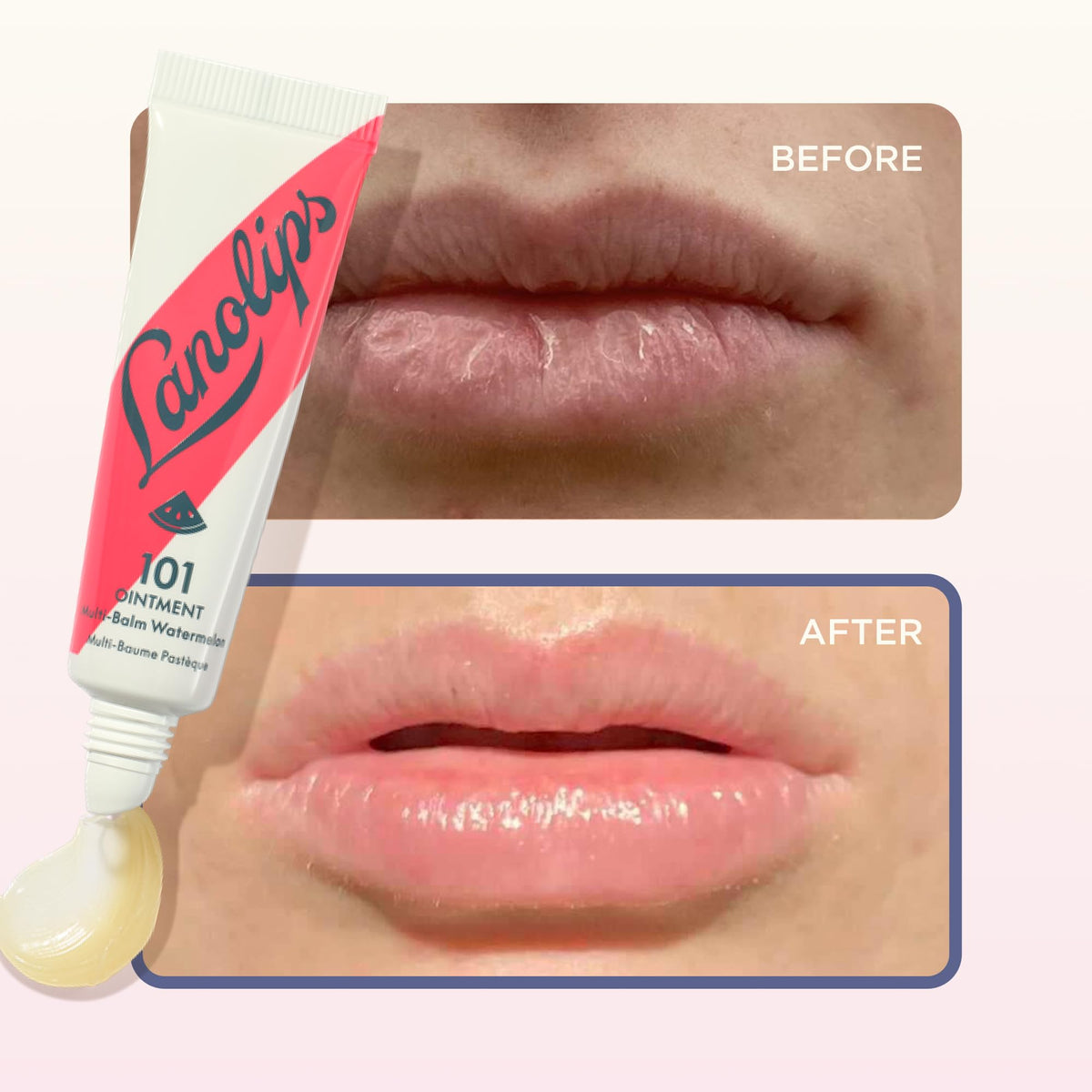 Lanolips 101 au Melon posé sur un bureau
