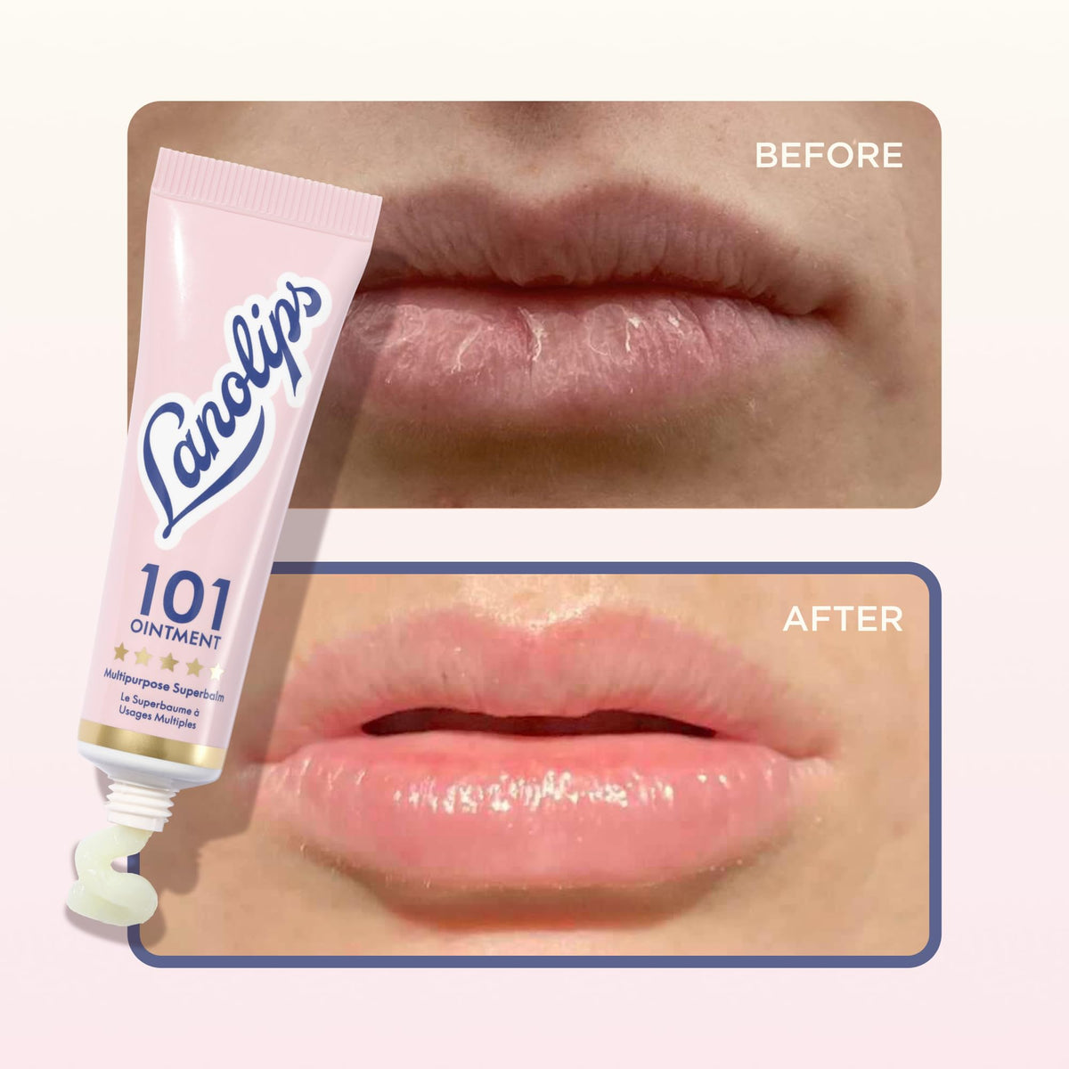Lanolips Baume 101 pour cuticules et coudes