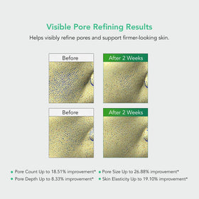 LEADERS Pore Tightening Toner Pad in hand