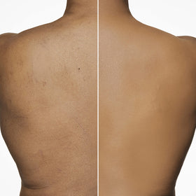 Maquillage léger avec Dermablend sur peau