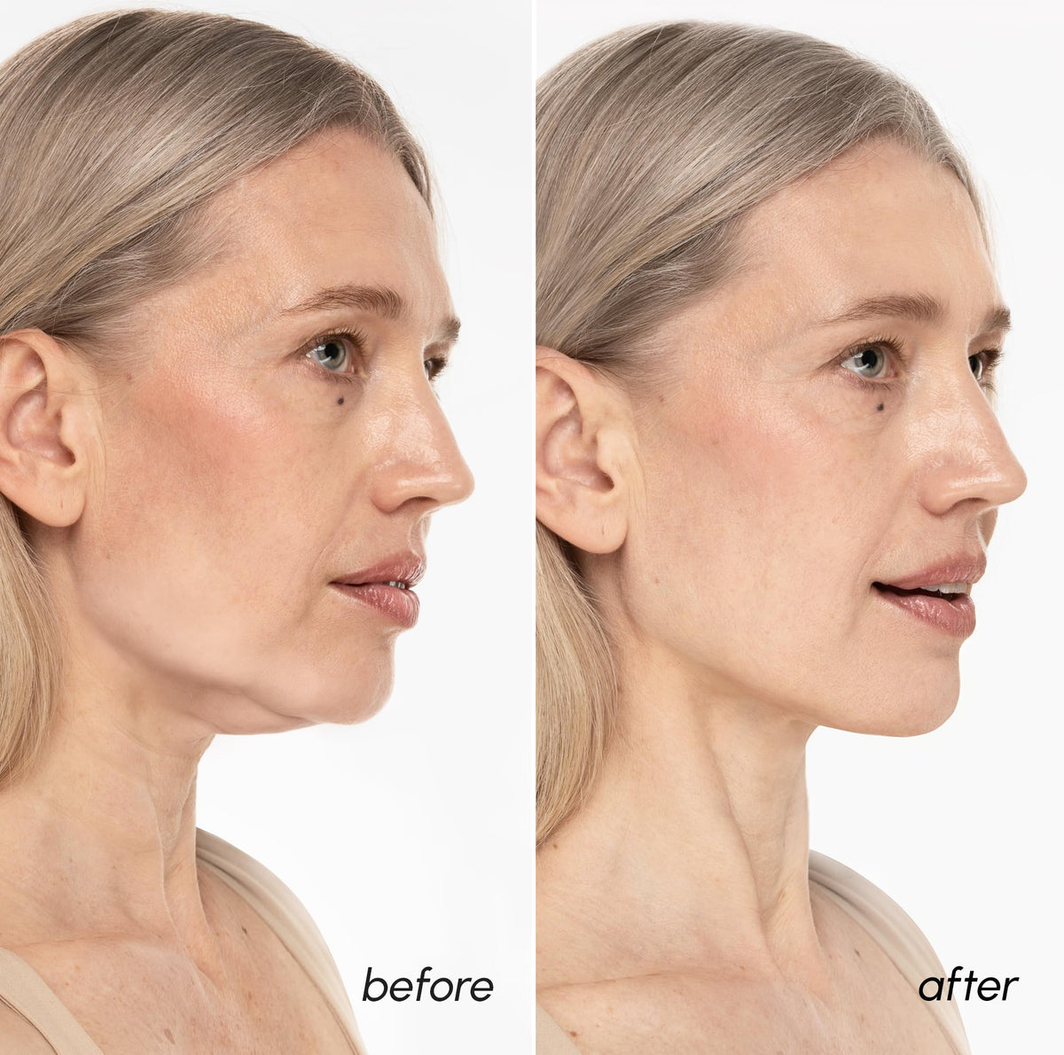 MAREE Masque V Line Lifting utilisation au quotidien
