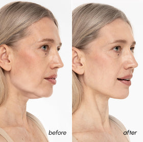 MAREE Masque V Line Lifting utilisation au quotidien