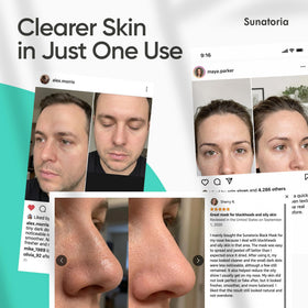 Masque au charbon actif SUNATORIA sur table de soins